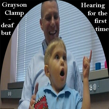 Grayson Clamp, n sourd, entend pour la premire fois  l'ge de 3 ans